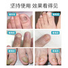 【买2送1买3送2买5送4】灰指甲液体敷料广药白云山出品实力祛灰甲植物配方温和不伤甲轻轻一抹灰甲变亮甲 商品缩略图4