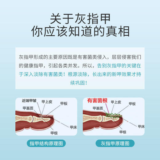 【买2送1买3送2买5送4】灰指甲液体敷料广药白云山出品实力祛灰甲植物配方温和不伤甲轻轻一抹灰甲变亮甲 商品图2