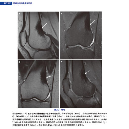 Oncologic Imaging :Bone Tumors （中文版） 商品图3