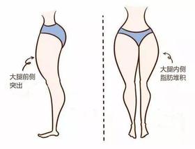 站着也能瘦腿的懒人健身拉筋板，每天坚持，下一个腿精就是你！ 