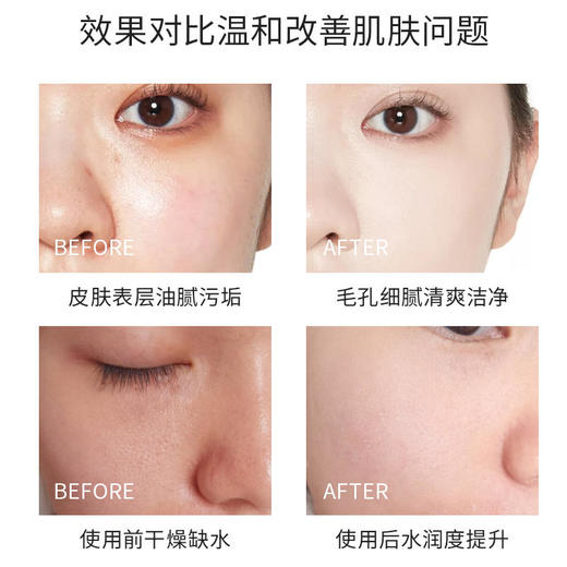 【脸部“泡泡浴”】以黑吸黑3秒自动发泡溶解毛孔里的脏东西改善黑头粉刺舒缓肌肤让皮肤畅快呼吸竹炭呼吸注氧泡泡面膜100ml/瓶 商品图5