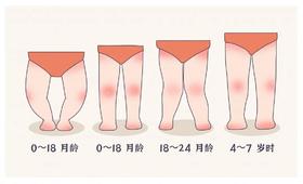 宝宝O型腿？X型腿？要腿长又直，这些事你不知道不行！ 