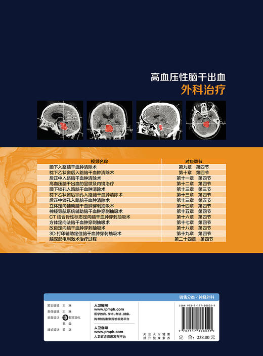 高血压性脑干出血外科治疗 商品图2