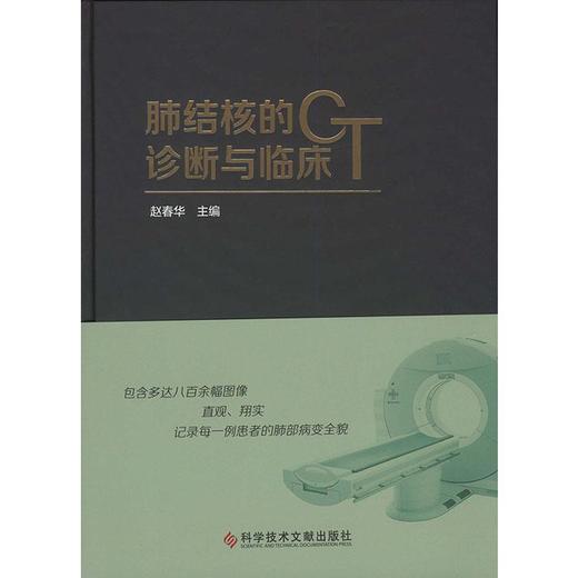 肺结核的CT诊断与临床 商品图0