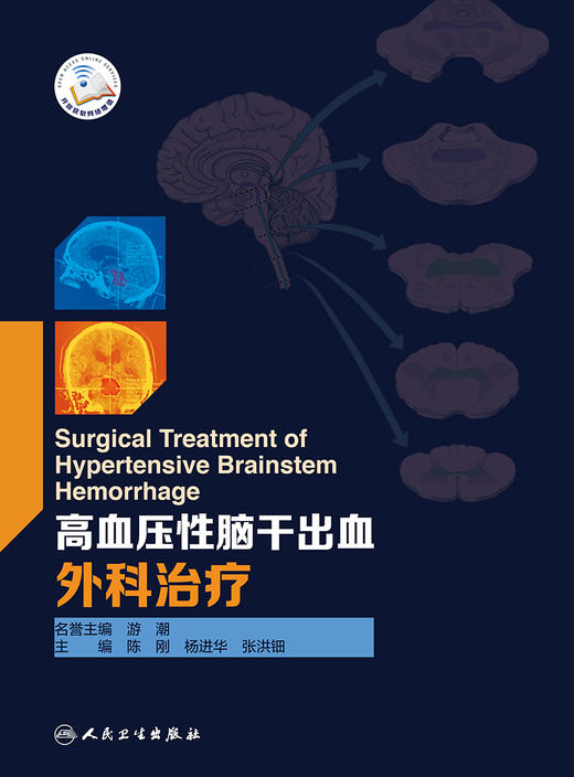 高血压性脑干出血外科治疗 商品图1