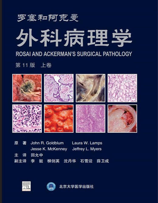 罗塞和阿克曼外科病理学 第11版上下册 高效准确的诊断肿瘤性和非肿瘤性疾病 实用软组织脊柱外科学 回允中主译9787565923364 商品图2