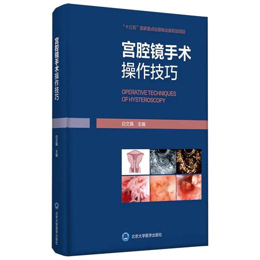 宫腔镜手术操作技巧（北医基金） [Operative Techniques of Hysteroscopy] 商品图0