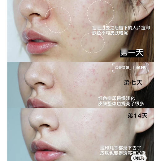 原价1560 美白紧致 雅诗兰黛肌光精华 面部肌光精华100ml 商品图2