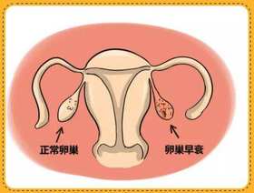 女性卵巢保养做不好，花再多钱都没用！ 