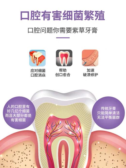 【买1送1 买2送2】抗敏感紫草牙膏hp去黄牙垢牙结石牙炎除口臭口气清新 商品图6