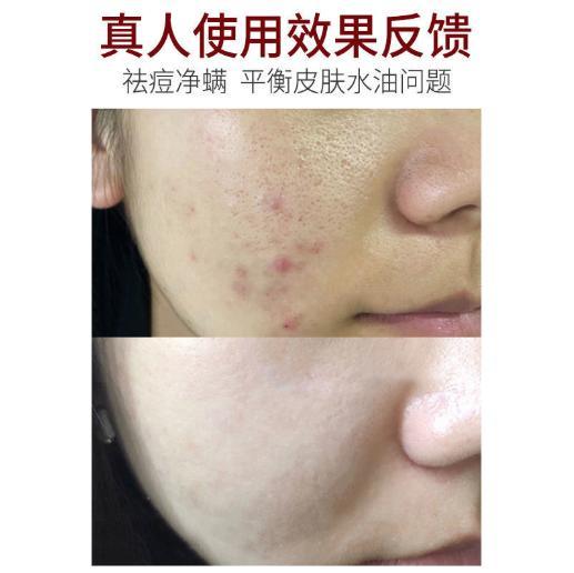 【买2送1】低温发酵天然发酵萃取抗螨皂小分子高渗透高活性温和抗螨温和无刺激人参酵素皂 商品图2