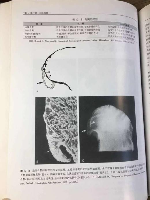 骨关节炎 商品图3