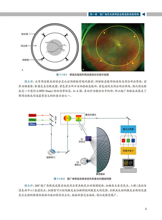 图说超广角荧光素眼底血管造影 图说眼科系列 陈长征 苏钰 郑红梅 编 眼科学书籍基层眼科医师 人民卫生出版社9787117314510 商品图3