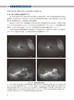 图说超广角荧光素眼底血管造影 图说眼科系列 陈长征 苏钰 郑红梅 编 眼科学书籍基层眼科医师 人民卫生出版社9787117314510 商品缩略图4