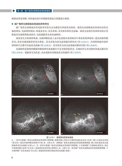 图说超广角荧光素眼底血管造影 图说眼科系列 陈长征 苏钰 郑红梅 编 眼科学书籍基层眼科医师 人民卫生出版社9787117314510 商品图4