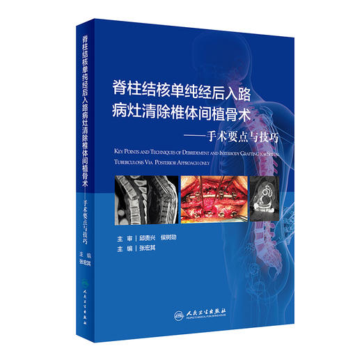 脊柱结核单纯经后入路病灶清除椎体间植骨术 手术要点与技巧 张宏其 主编 骨科学外科学书籍 人民卫生出版社9787117313681 商品图0