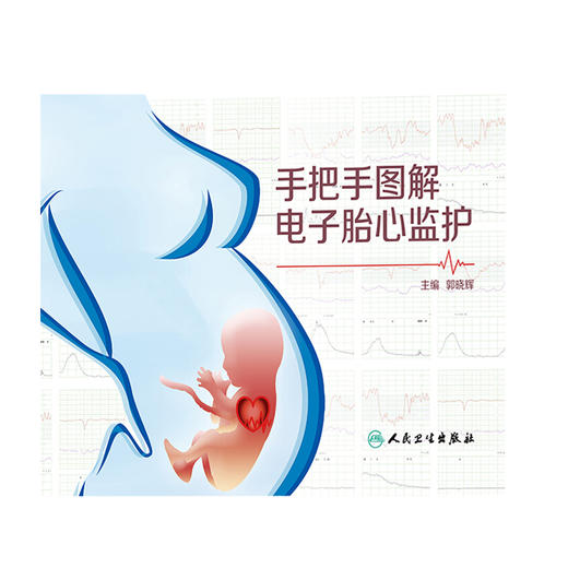 手把手图解电子胎心监护 胎心监护理论研究、监护方法的改进和和监护技术的发展 儿科学 郭晓辉 9787117282581人民卫生出版社 商品图2