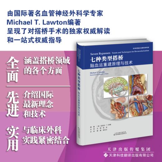 七种类型搭桥：脑血运重建原理与技术 神经 脑血管疾病 神经外科手术 商品图0