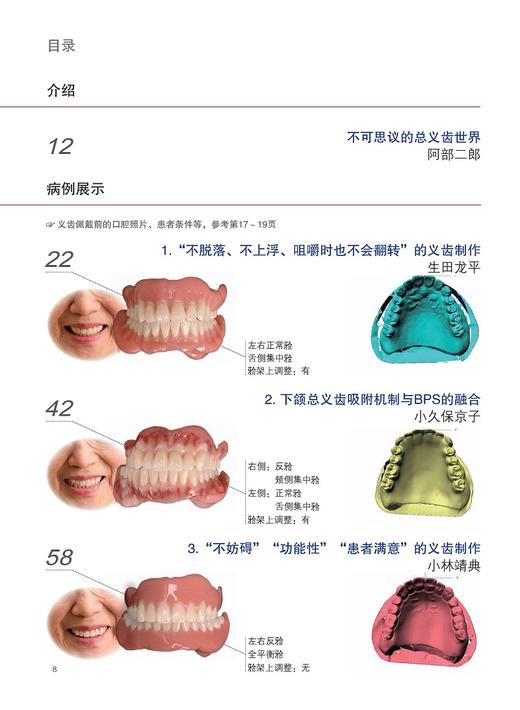 具有稳定咬合的总义齿形态 对临床有非常强的指导意义口腔科学书籍 生田龙平小久保京子主编9787559119681辽宁科学技术出版社 商品图3