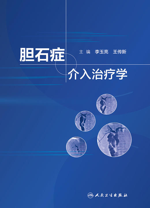 胆石症介入zhi疗学 商品图1