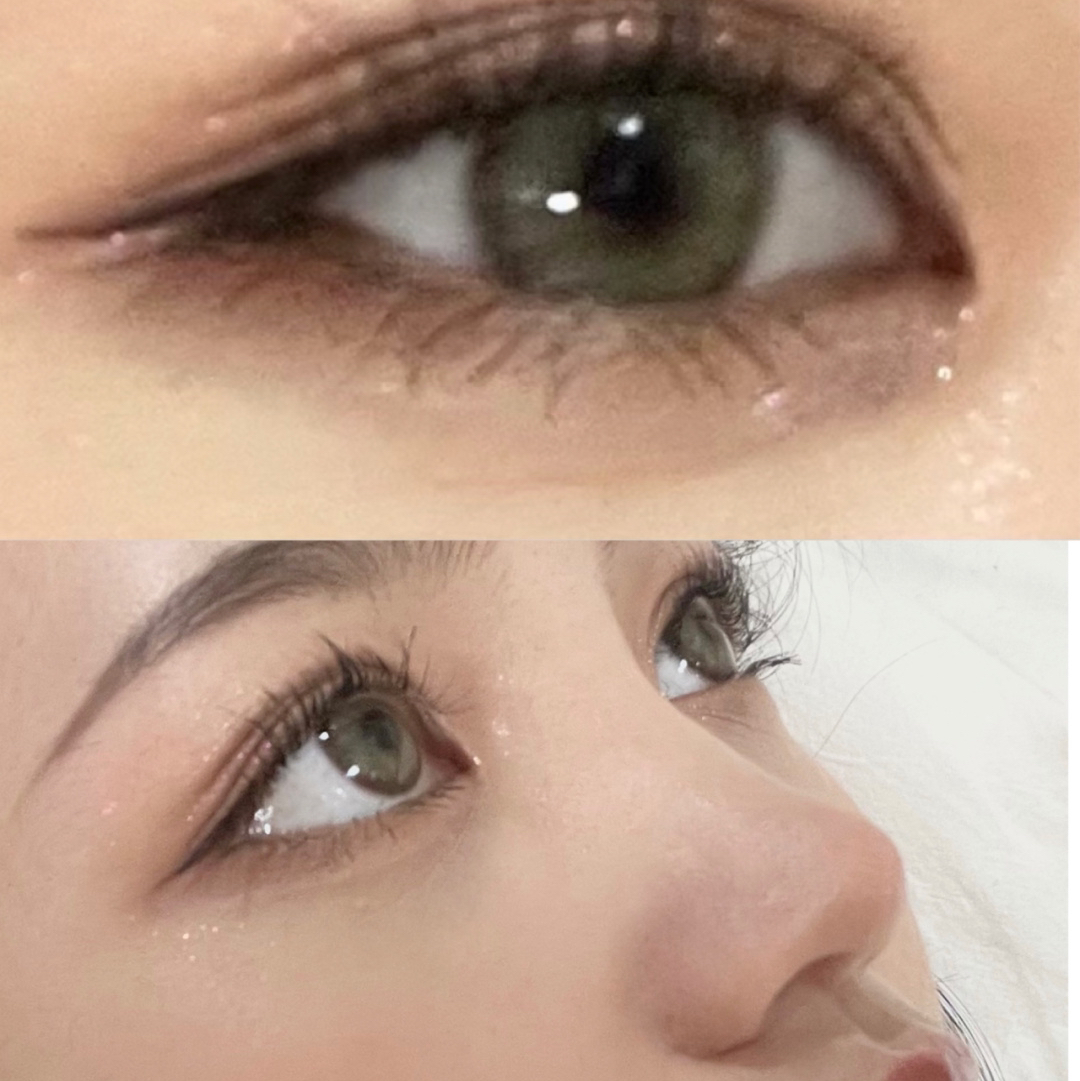 Pinkg 吉隆坡(半年抛玻尿酸）