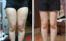 喝口凉水都长胖！每次2颗它，软糯香甜像吃点心，告别“假胖”，痘痘、疲乏也一扫光 