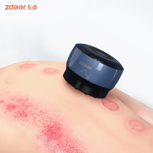 左点（Zdeer）砭石温灸仪智能走罐按摩器 商品图5