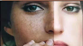  脸上有斑老20岁！“用它”美白祛斑胜过打针，28天口碑见证堪比换皮！ 