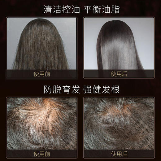 【洗发水】仁和去屑止痒控油防脱育发增发密发生姜洗发水 商品图1