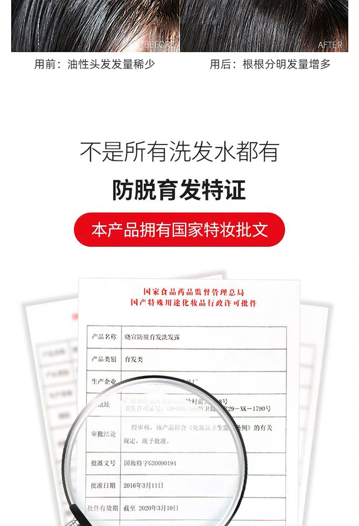 防脱洗发水01_10