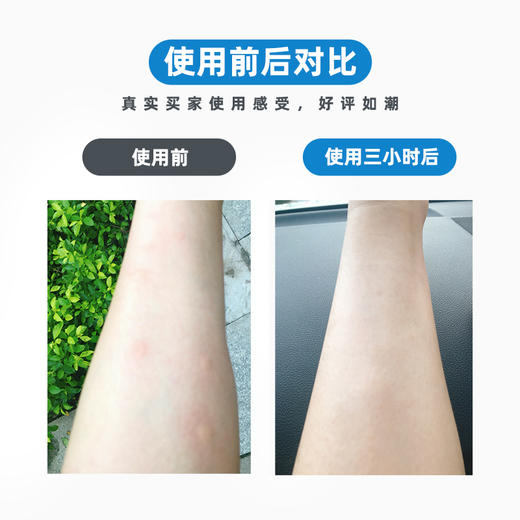 【无比滴防蚊液】日本原装婴儿成人止痒液驱蚊 防蚊虫叮咬宝宝儿童驱蚊液40ml 商品图5