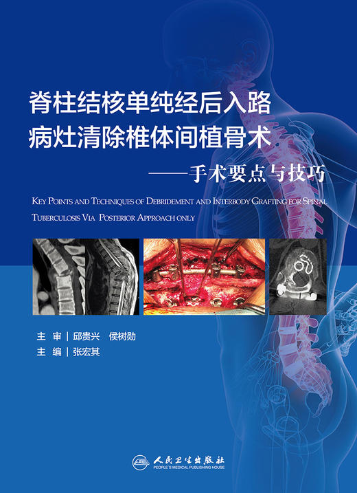 脊柱结核单纯经后入路病灶清除椎体间植骨术 手术要点与技巧 商品图1