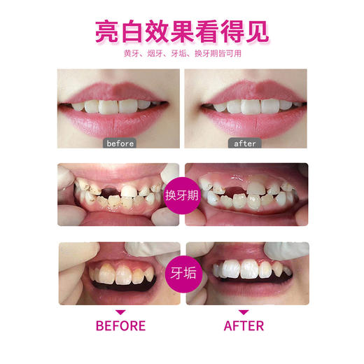 【品牌直发】包邮：瑞士进口Dr.wild怀尔德DEPURDENT抛光去渍牙膏50ml/75ml 商品图3