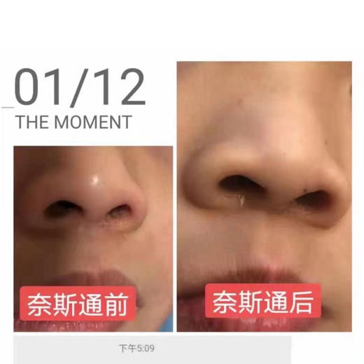 喷鼻剂鼻子喷雾洗鼻器鼻腔宝宝婴幼儿童海盐水洗喷鼻神器 商品图2