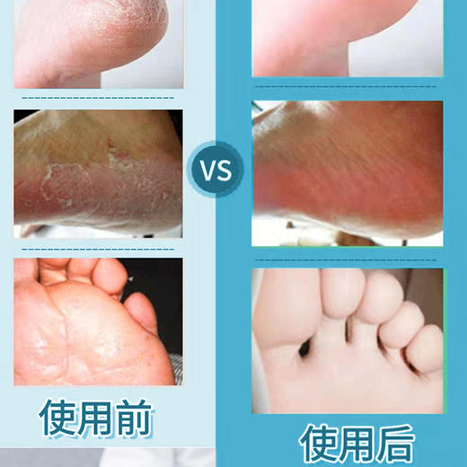 【远离臭脚，脱鞋不怕臭】铜纤维除臭鞋垫 持专利抗制菌技术！轻薄透气不发臭、吸湿吸汗排热、柔软舒适不硌脚、享受健康生活！.01 商品图5