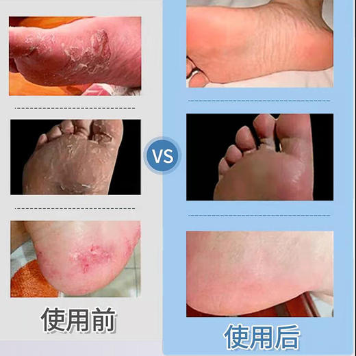 【远离臭脚，脱鞋不怕臭】铜纤维除臭鞋垫 持专利抗制菌技术！轻薄透气不发臭、吸湿吸汗排热、柔软舒适不硌脚、享受健康生活！.01 商品图6