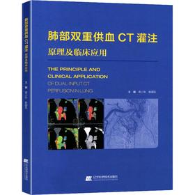肺部双重供血CT灌注成像原理及临床应用