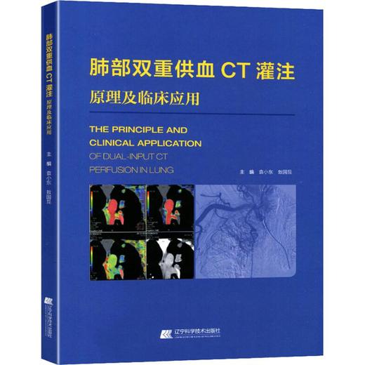 肺部双重供血CT灌注成像原理及临床应用 商品图0