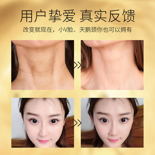 【买3发5,买4发7】玻色因扶纹美颈提拉塑颜面膜 淡化颈纹提拉紧致颈部除皱亮白V脸多效合一 3片/盒 商品图6