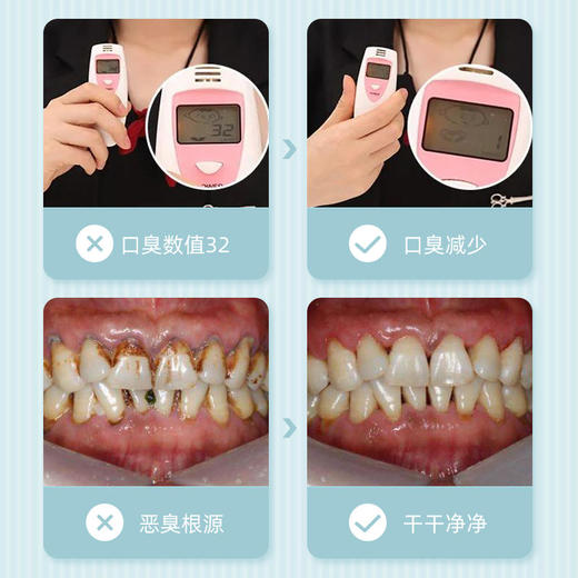【买4送3】HZ专研抗口臭牙膏含多元抗臭成分焕白牙齿清新口气100g/支 商品图4