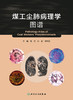 煤工尘肺病理学图谱 商品缩略图1
