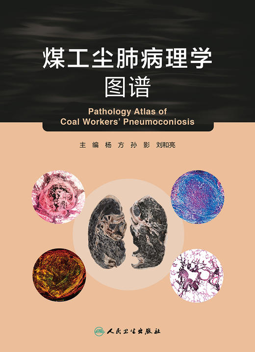 煤工尘肺病理学图谱 商品图1