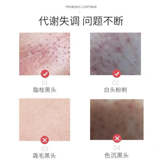 燕麦多糖癸酸精华液（全新升级） 商品图2