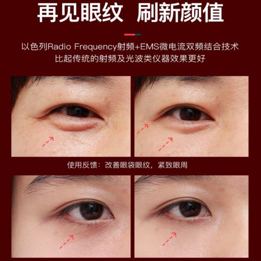 以色列Soulink小红笔眼部美容仪 小尖刀射频按摩去眼袋神器 [福利品] 商品图2