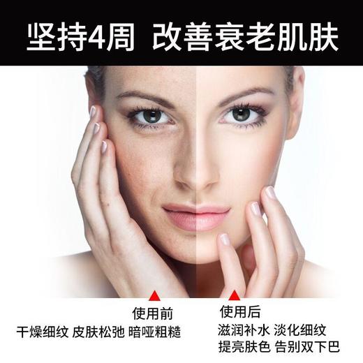 MARASIL/玛瑞莎 小海豚刮痧板面部提拉紧致瘦脸仪美容仪 [福利品] 商品图3