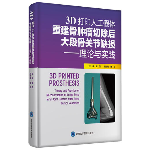 3D打印人工假体重建骨肿瘤切除后大段骨关节缺损——理论与实践  主编 郭卫  北医出版 商品图0