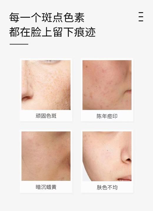 贝露丝 传明酸润白精华液 30ml 商品图2