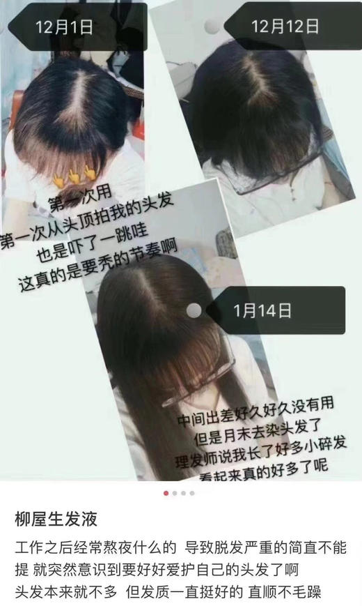 柳屋生发液 让你绝处逢生 商品图2