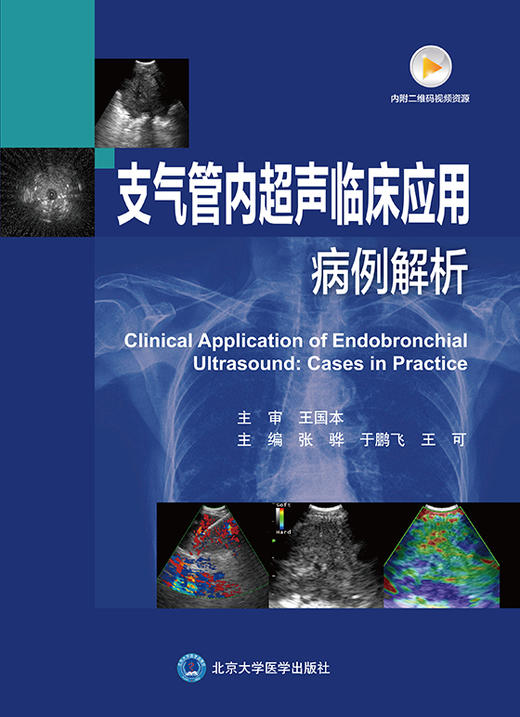 支气管内超声临床应用病例解析 间质性肺疾病及其他疾病 肺部肿瘤 张骅 于鹏飞 王可 主编 9787565923845 北京大学医学出版社 商品图2
