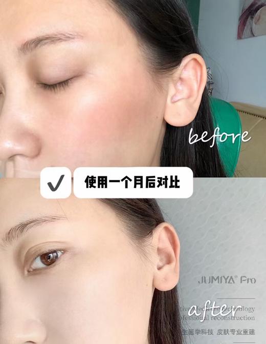 绽美娅医用医用透明质酸皮肤修护敷料非面膜6片/盒【院版 械字号】 商品图3